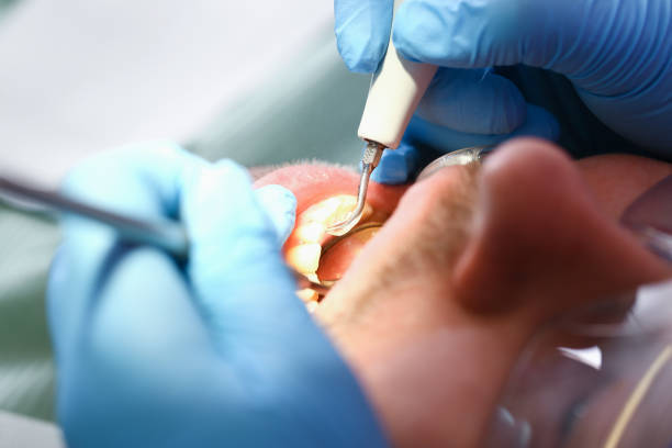 Best Broken or Cracked Tooth Emergency Dentist in Wedgefield, FL